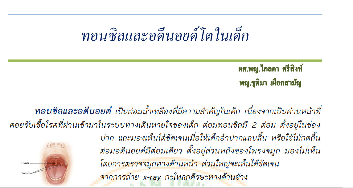 ทอนซิลและอดีนอยด์โตในเด็ก