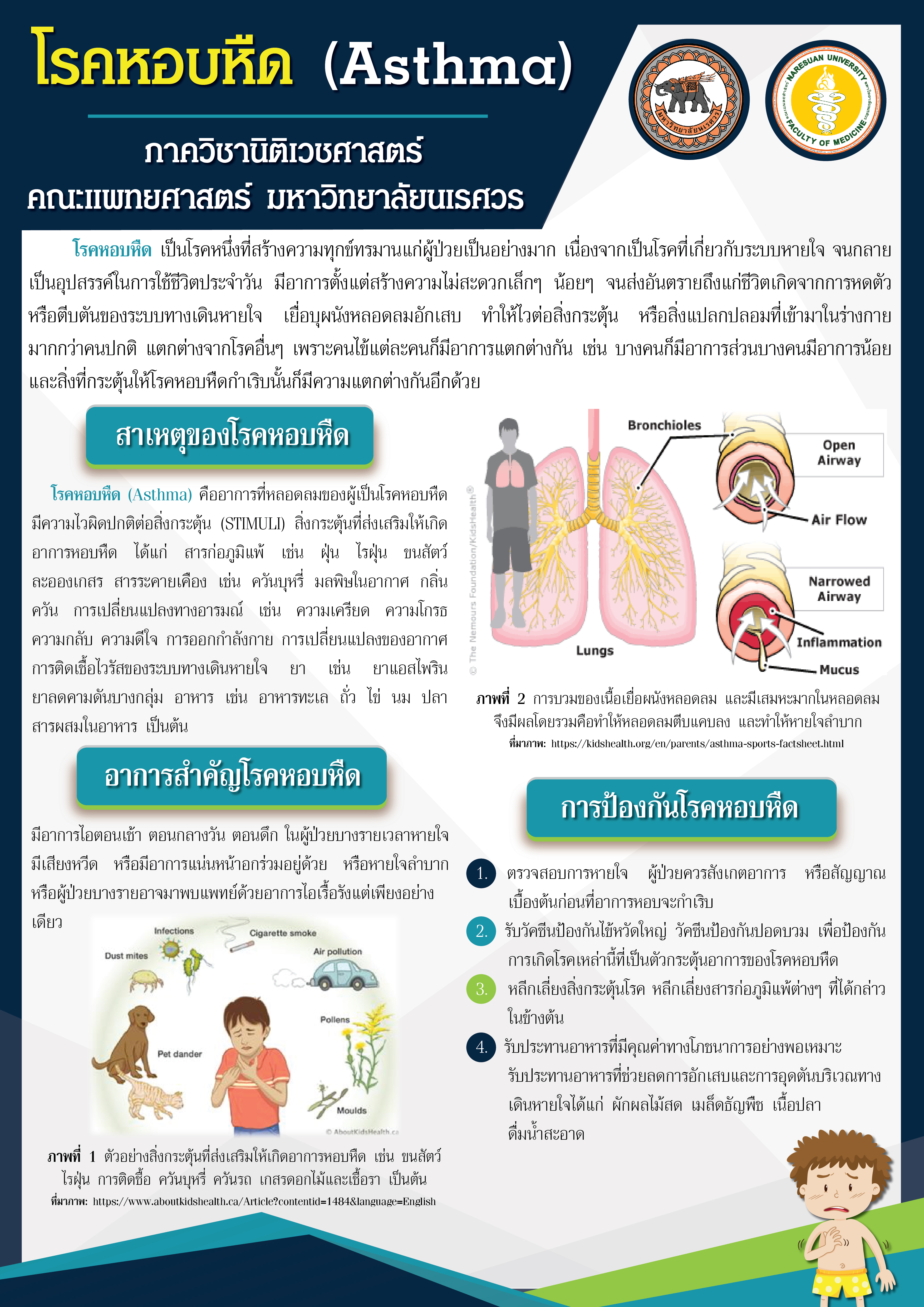 โรคหอบหืด (Asthma)