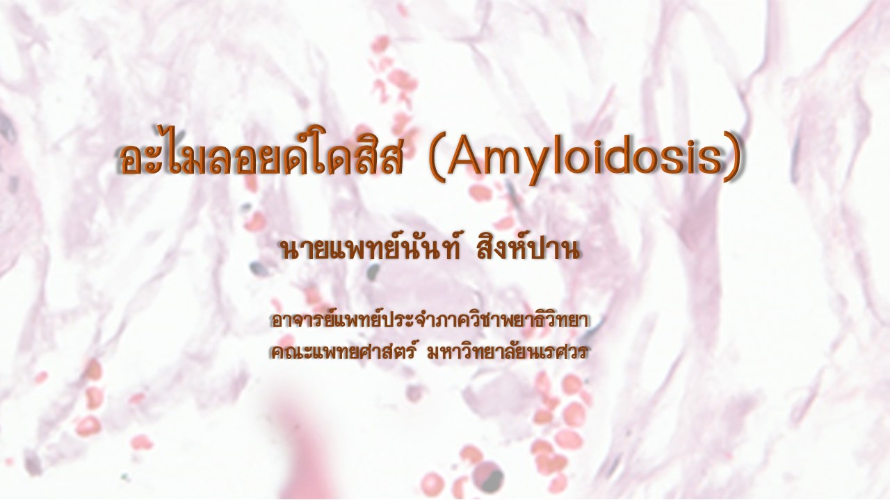อะไมลอยด์โดสิส (Amyloidosis)