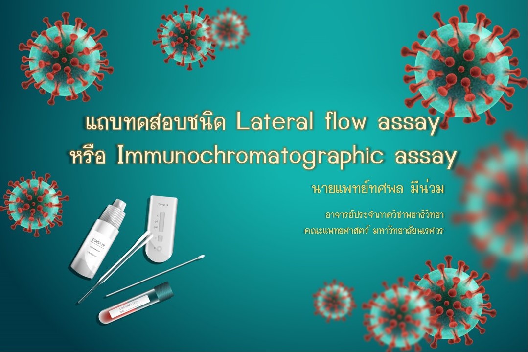 แถบทดสอบชนิด Lateral flow assay หรือ Immunochromatographic assay