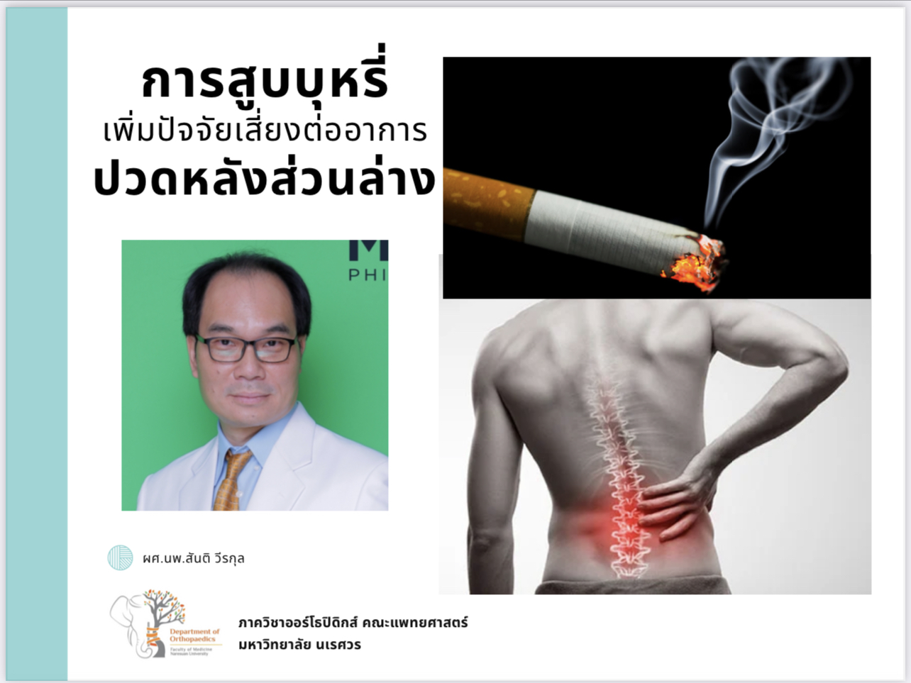 การสูบบุหรี่เพิ่มปัจจัยเสี่ยงต่ออาการปวดหลังส่วนล่าง