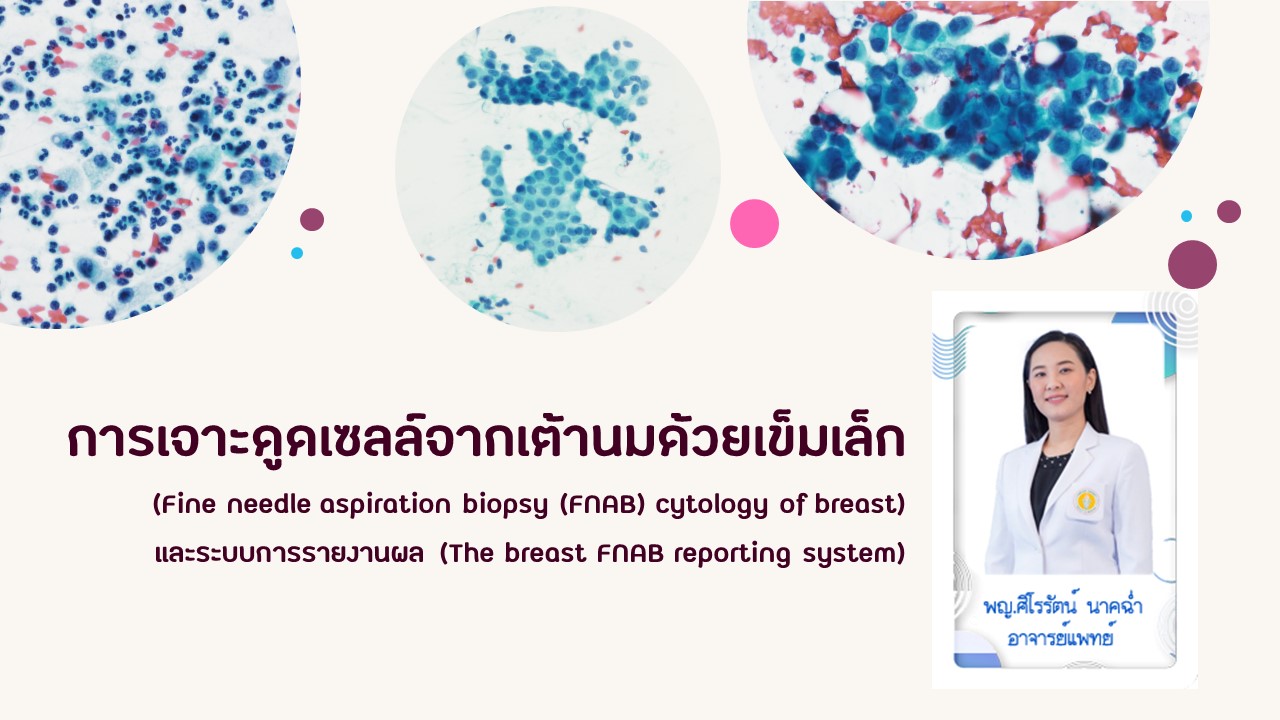 การเจาะดูดเซลล์จากเต้านมด้วยเข็มเล็ก  (Fine needle aspiration biopsy (FNAB) cytology of breast)  และระบบการรายงานผล (The breast FNAB reporting system)