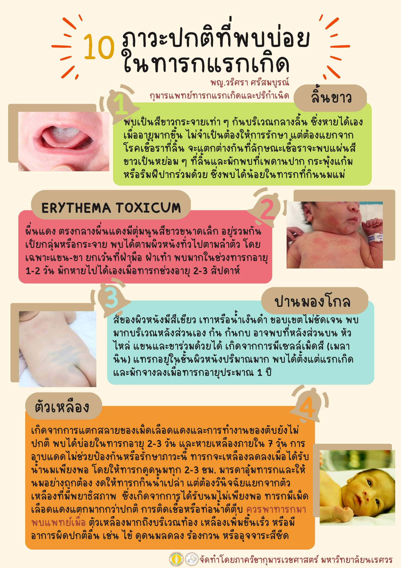 10 ภาวะปกติที่พบบ่อยในทารกแรกเกิด