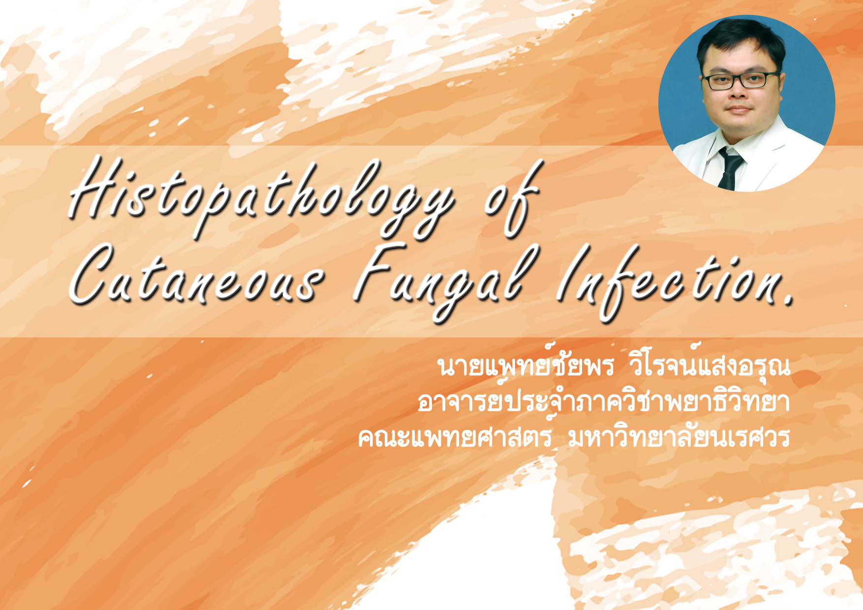 Histopathology of Cutaneous Fungal Infection