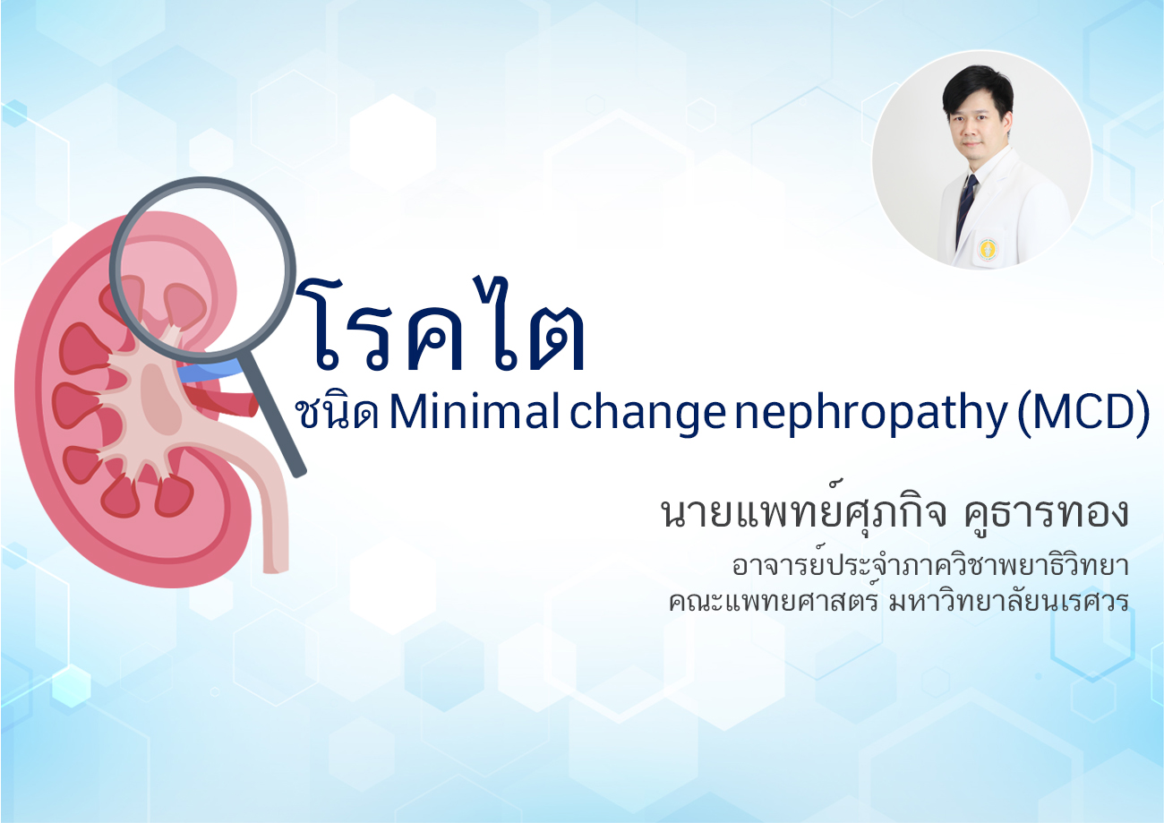 โรคไตชนิด Minimal change nephropathy (MCD)