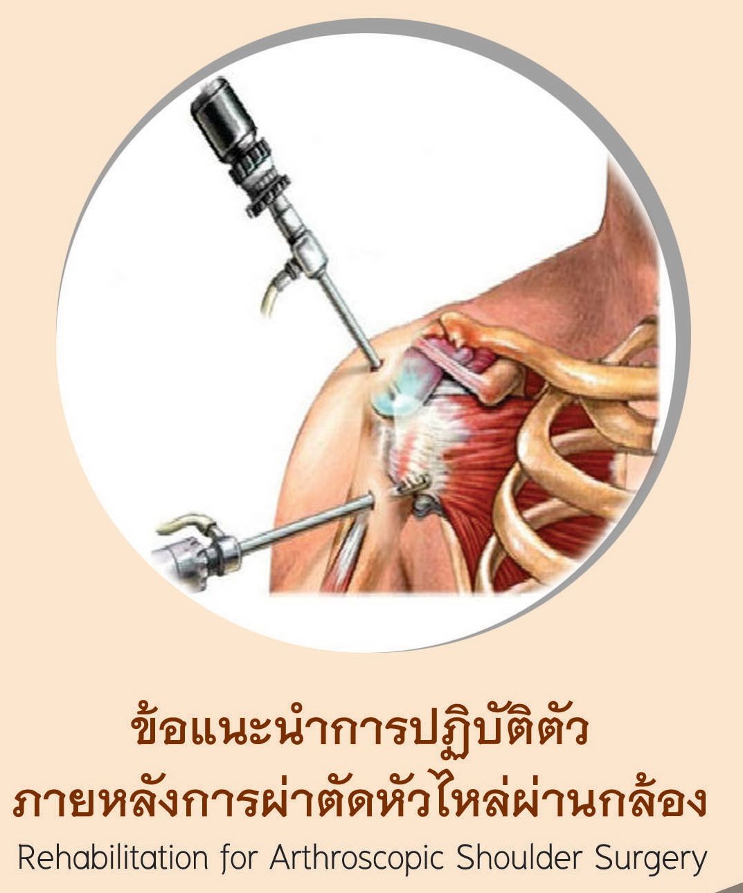 ข้อแนะนำการปฏิบัติตัวภายหลังการผ่าตัดหัวไหล่ผ่านกล้อง