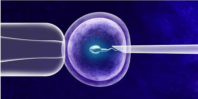 389_ivf-icsi.jpg